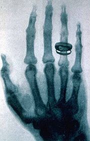 Radiology WeeK, x-ray of hand